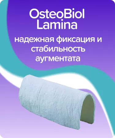OsteoBiol Soft Cortical Lamina мембрана 25х25мм / конский