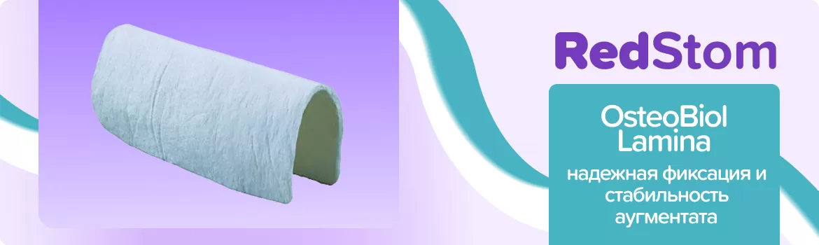 OsteoBiol Soft Cortical Lamina мембрана 25х25мм / конский