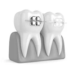 Ортодонтия