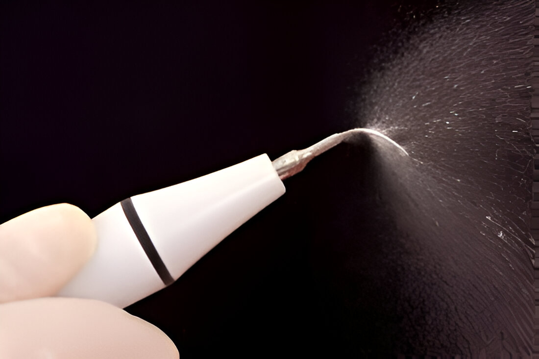 Ультразвуковой скейлинг